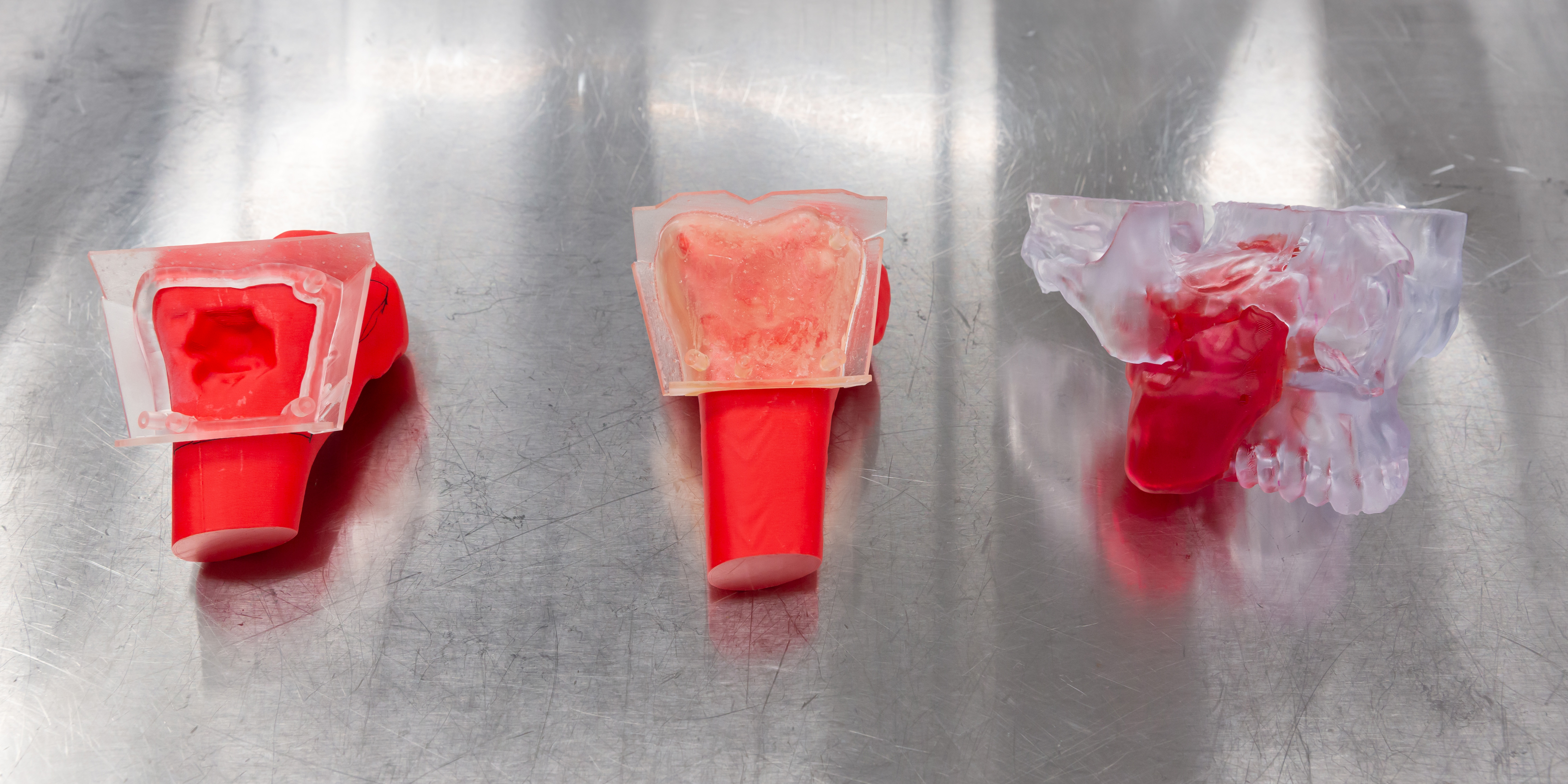 Examples of 3D models used in surgeries, including a jaw model and those used in orthopaedic surgeries.