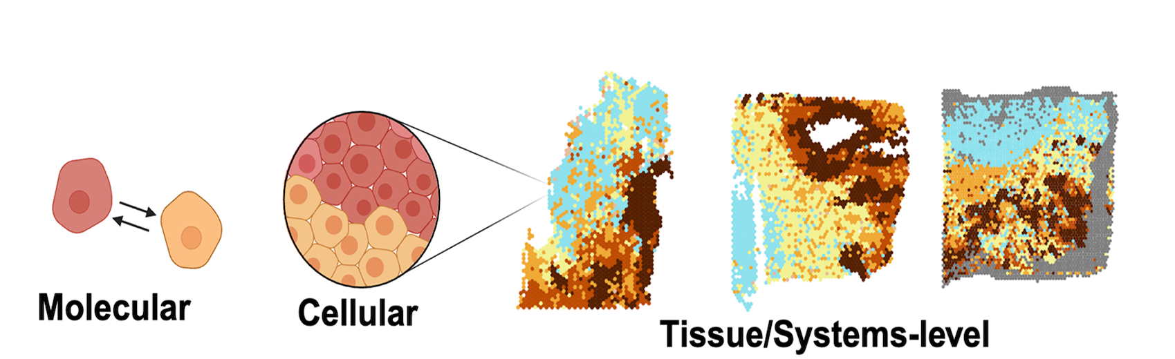 Scientific illustration of Dr. Alissa Greenwald's first project of spatially mapping tumours. 