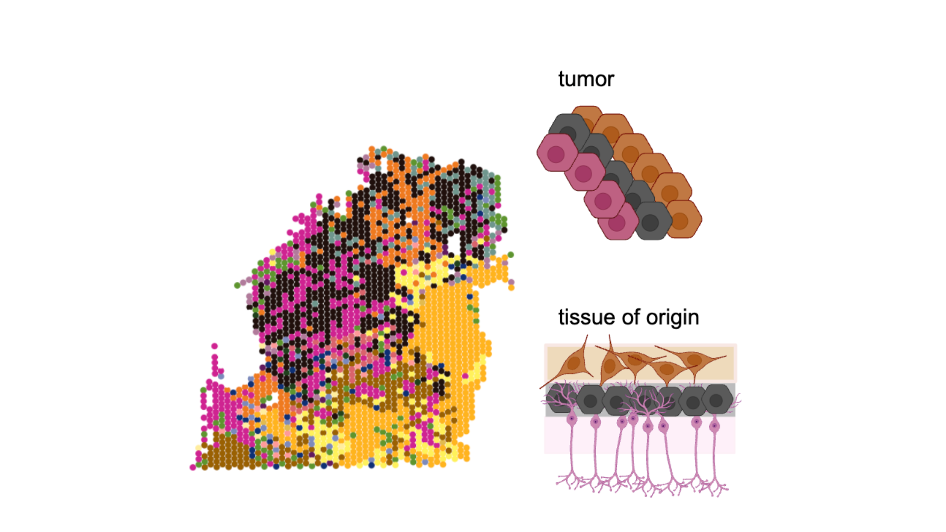 Scientific illustration of Dr. Alissa Greenwald's second project on tumour organization and spatial patterning. 