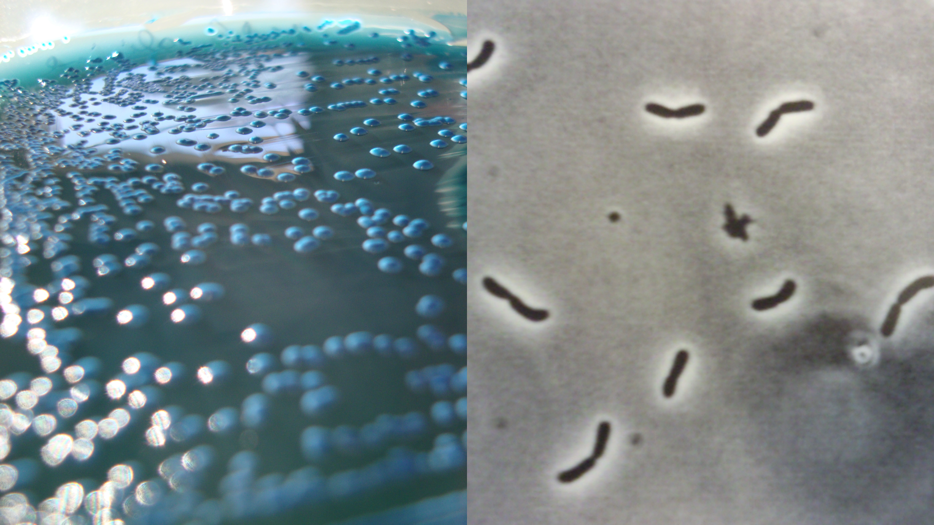 Collage of two images of bacteria that Dr. Williams Turpins studies in his lab. 