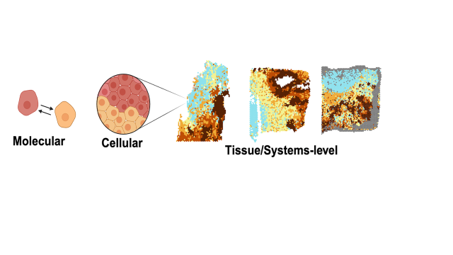 Scientific illustration of integrating spatial information across molecular, cellular and tissue scales to understand the principles of tumour organization.