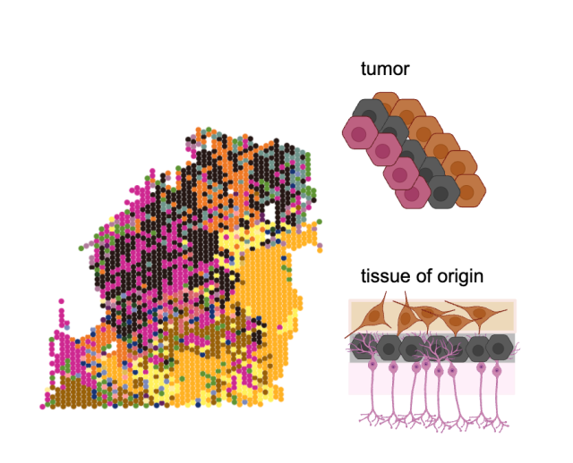 Scientific illustration of cancer cell states mimicking spatial associations of their tissue of origin.