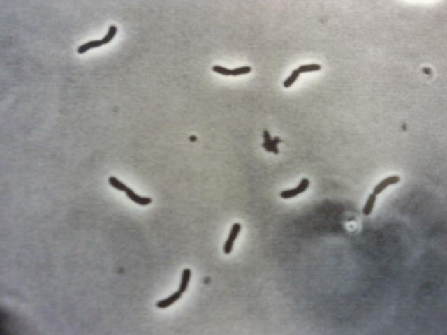 Rod-shaped bacterial cells under light microscopy. 