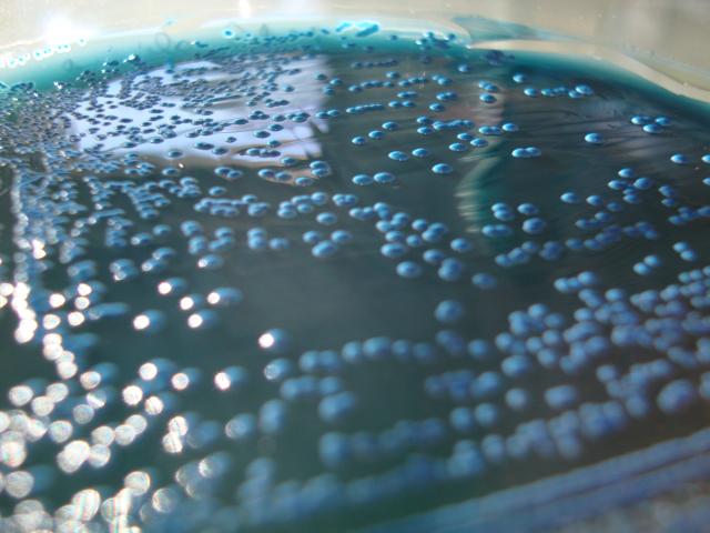 Close-up shot of a culture plate of bacteria. 