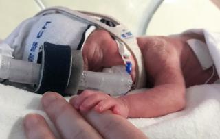 A newborn baby in intensive care