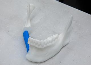 3D printout of a jaw
