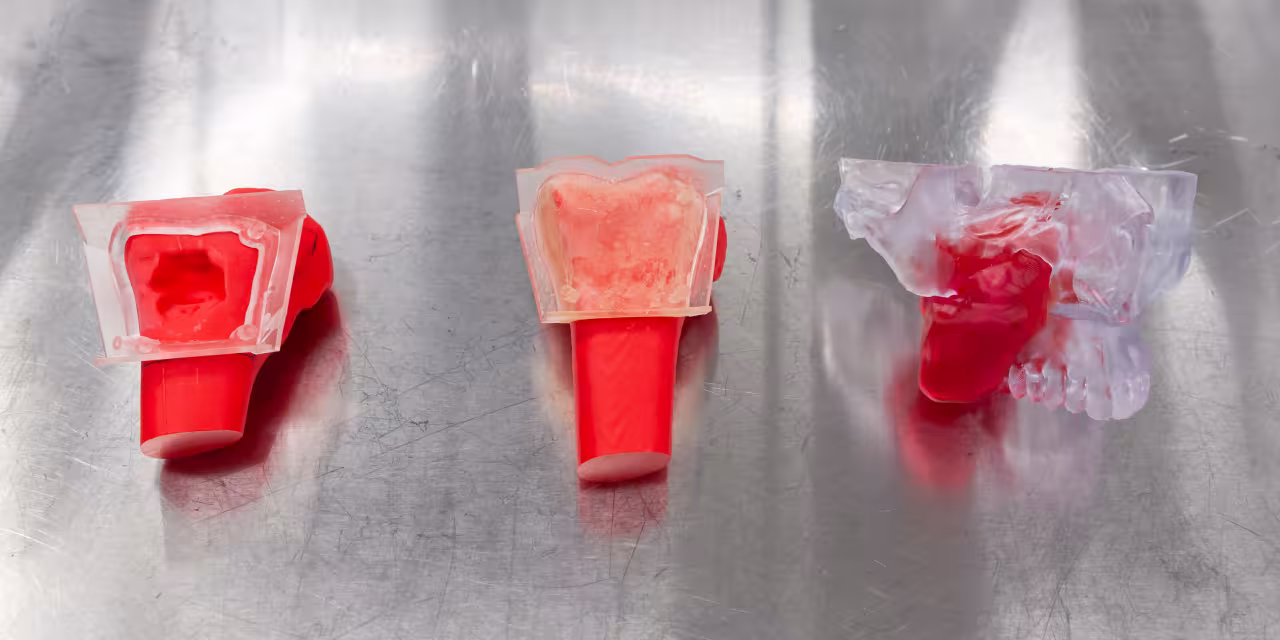 Examples of 3D models used in surgeries, including a jaw model and those used in orthopaedic surgeries.