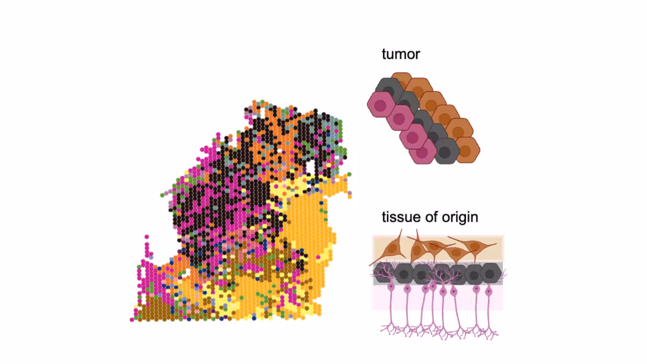 Scientific illustration of Dr. Alissa Greenwald's second project on tumour organization and spatial patterning. 