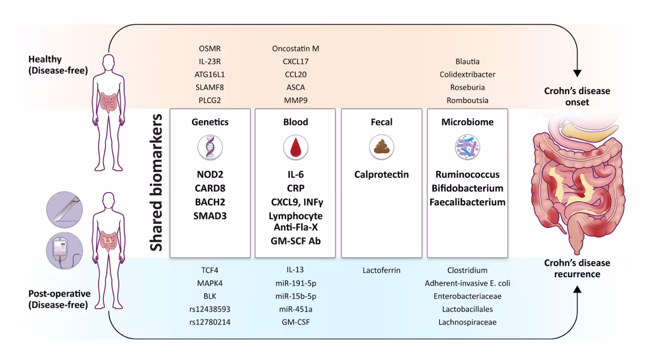 Schematic of biomarkers found in preclinical phase of Crohn's disease and the disease-free state after ileocolic resection. 