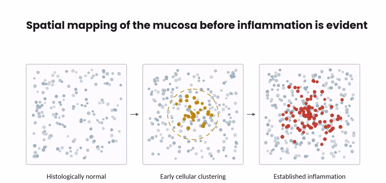 Spatial mapping schematic of the mucosa before inflammation is evident.