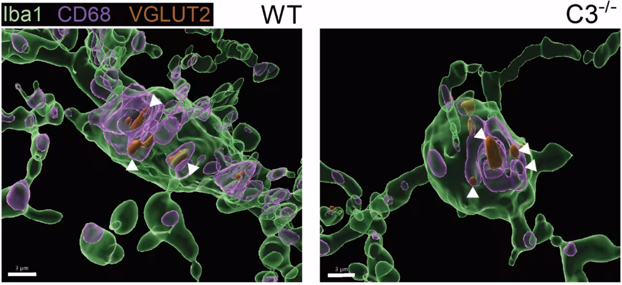 Scientific illustration of microglial pruning of excitatory synapses in the hippocampus.