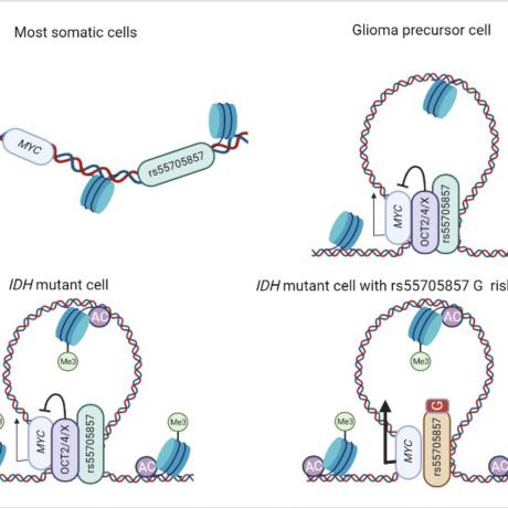 Illustration comparing chromatin looping between MYC and the rs55705857 locus in somatic, glioma‑precursor, IDH‑mutant, and IDH‑mutant risk‑allele cells, showing how regulatory interactions change MYC expression.