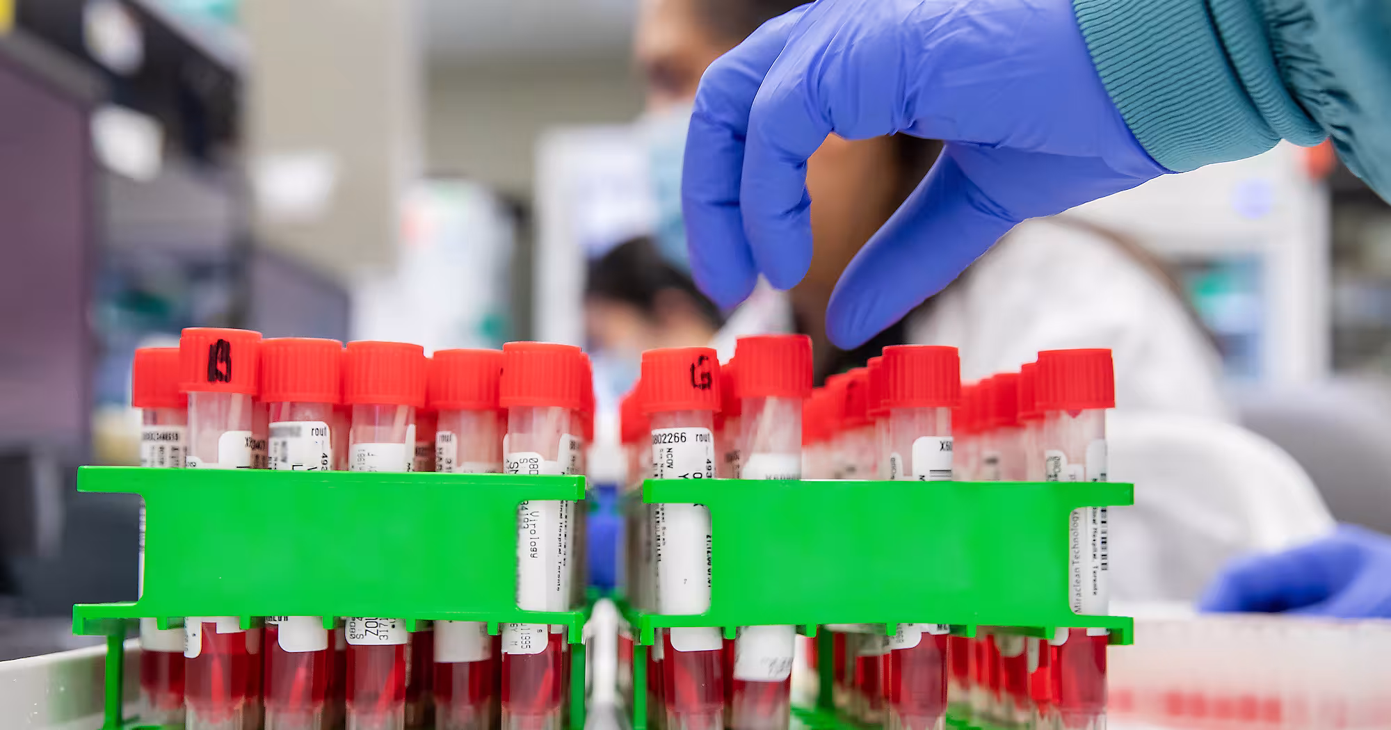 Gloved hand reaching over vials of blood in a lab.