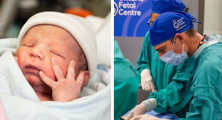 collage of a newborn in left panel and a surgical team working in right panel