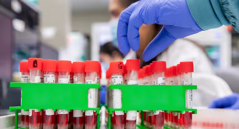 Gloved hand reaching over vials of blood in a lab.