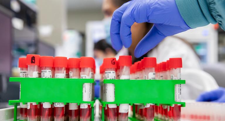 Gloved hand reaching over vials of blood in a lab.